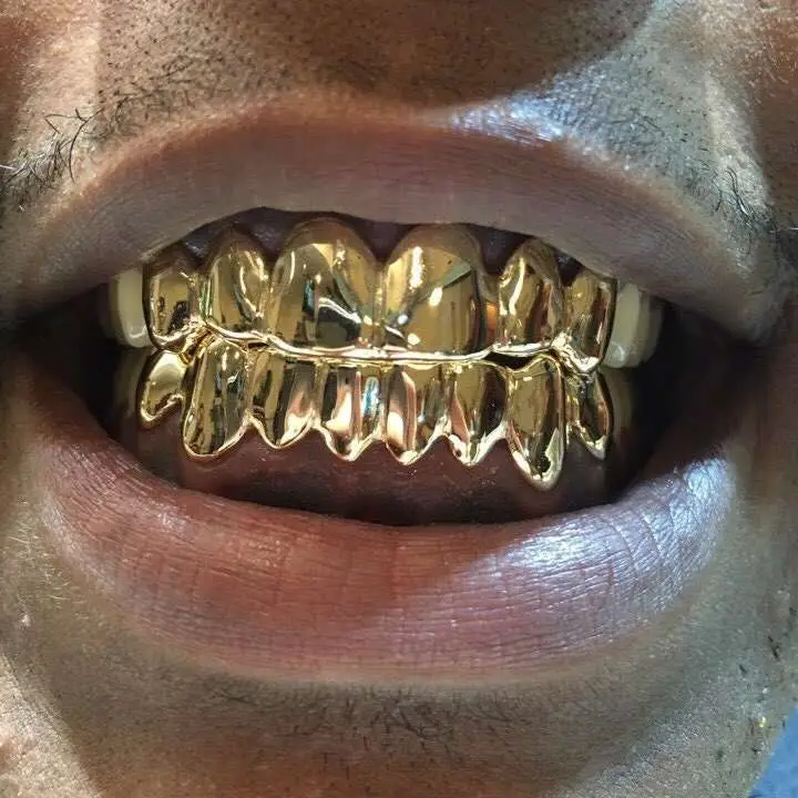 18K Solid Yellow Gold Custom fit REAL Gold Grill Grillz ...