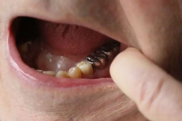Bamboozled: What happens to gold teeth when someone is ...