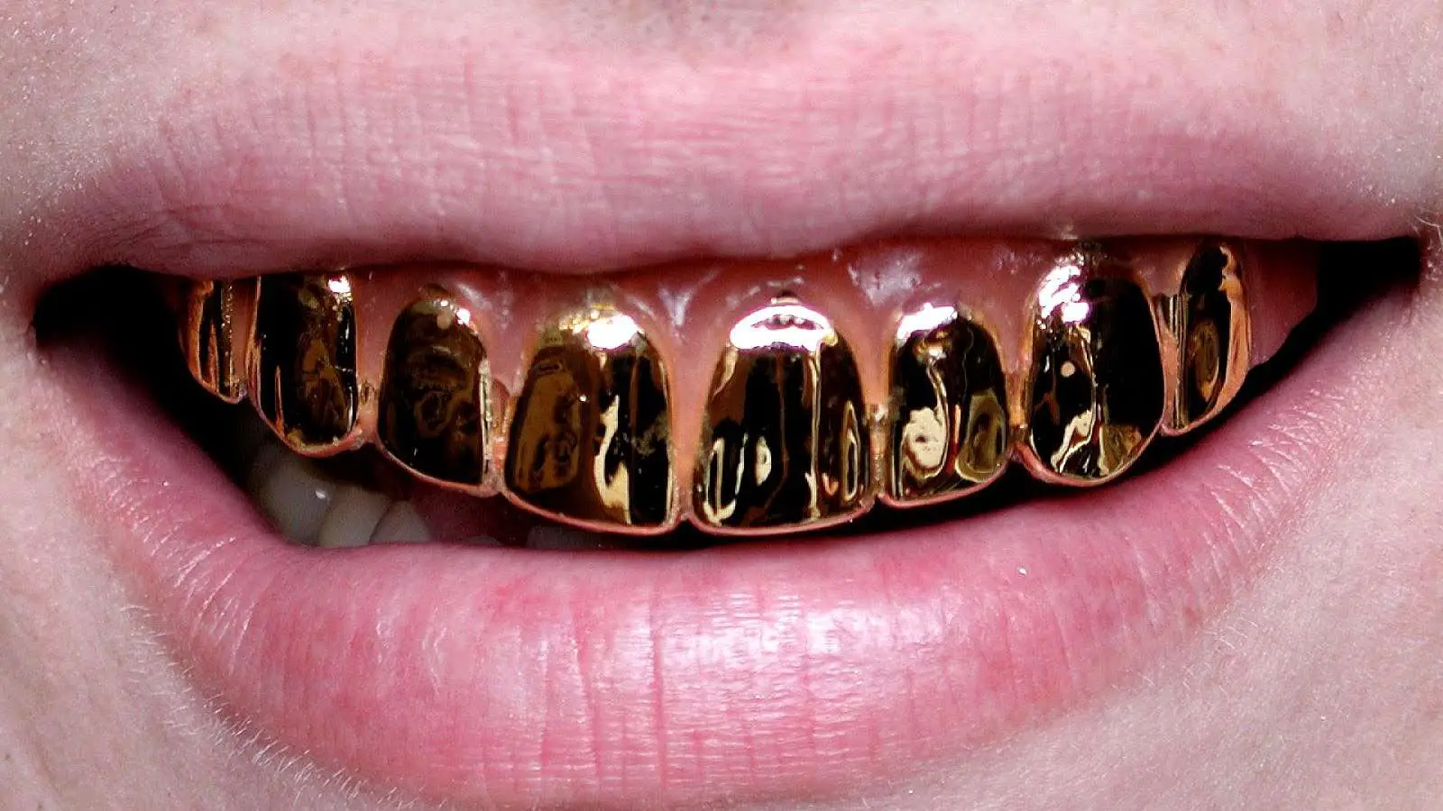 Girls With Gold Teeth
