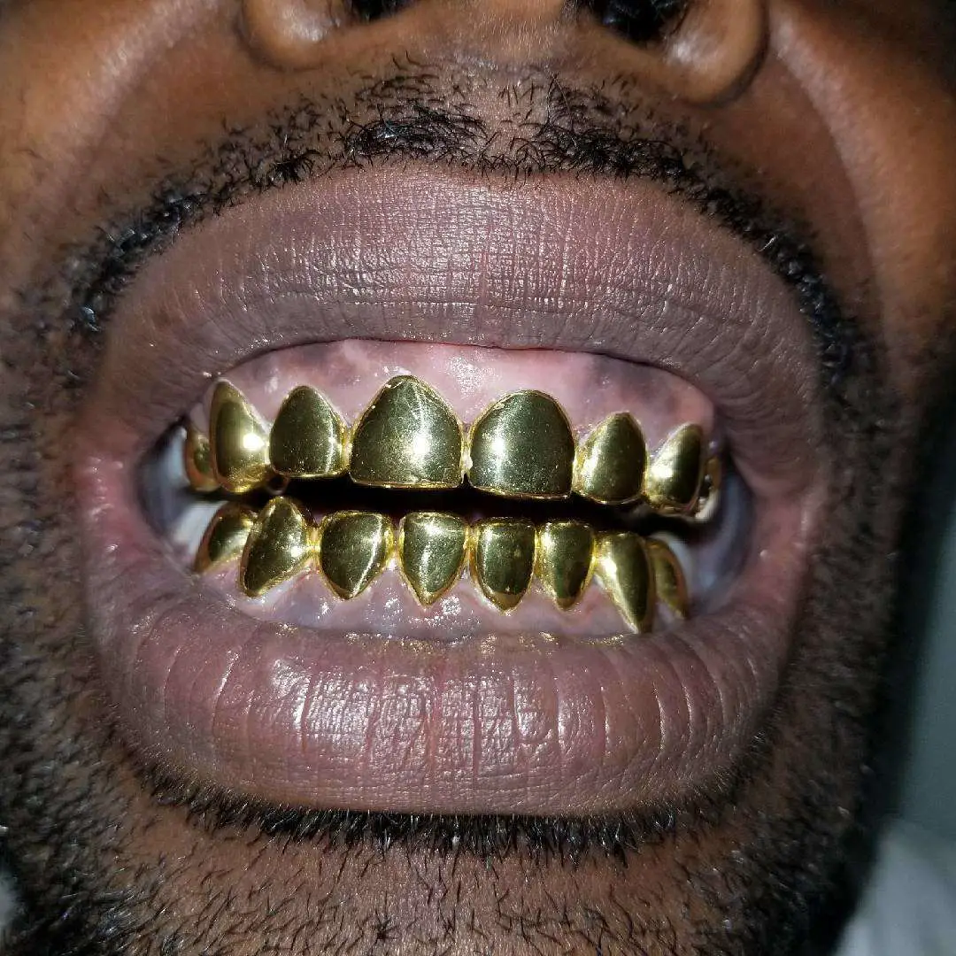 How Much Does 2 Gold Teeth Cost