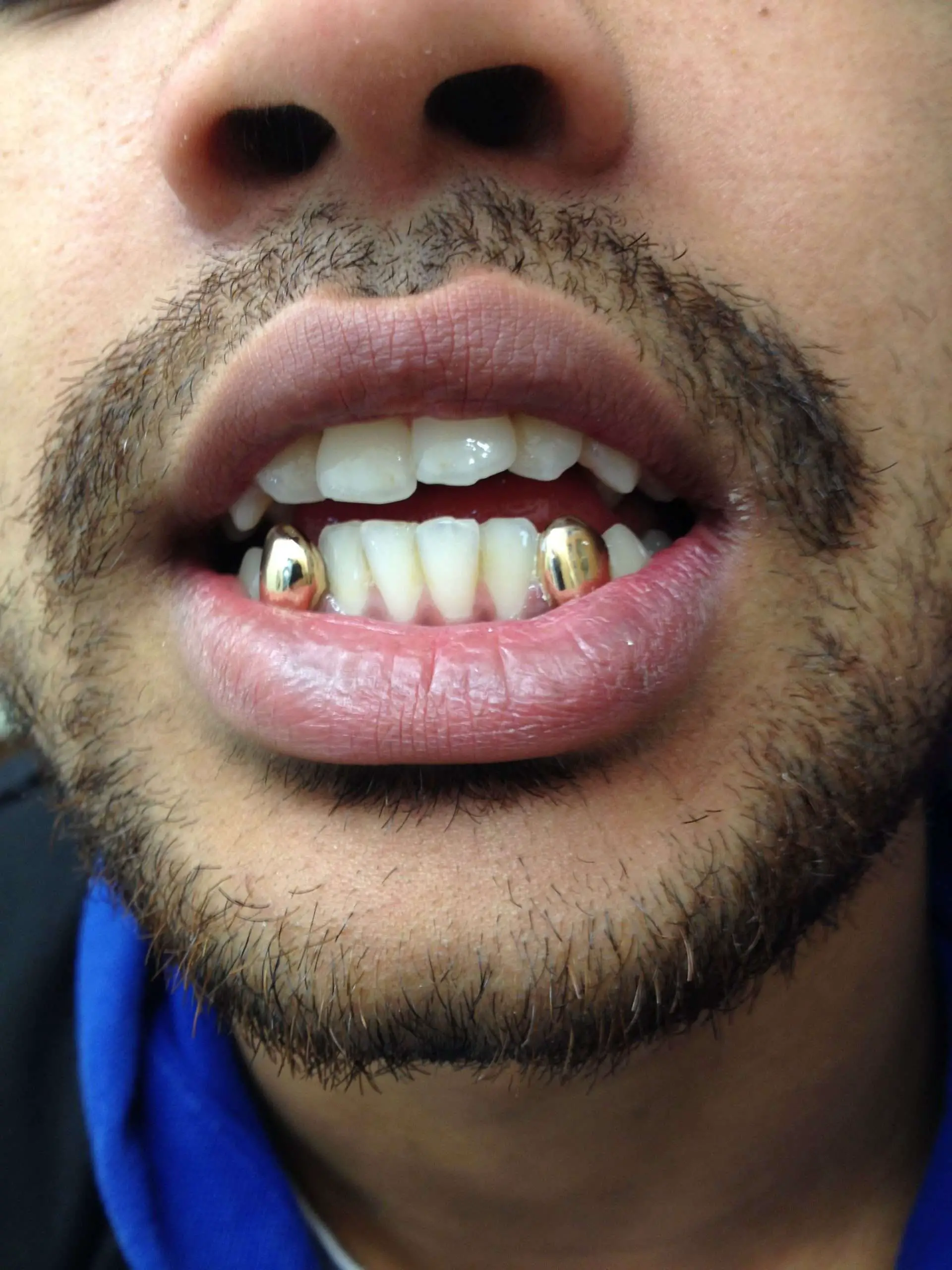 How Much Is A Gold Tooth Cap / Punk Gold Teeth Grills Hiphop Vampire ...