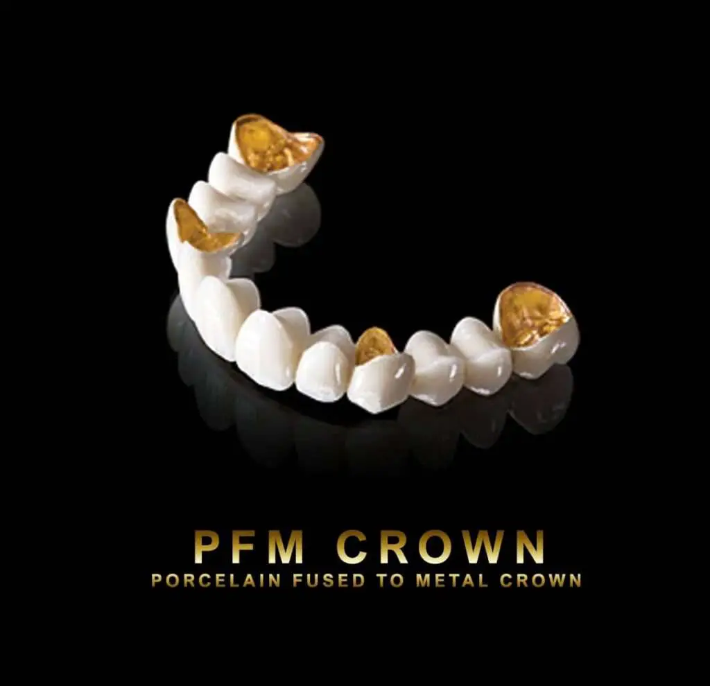 PFM Crown
