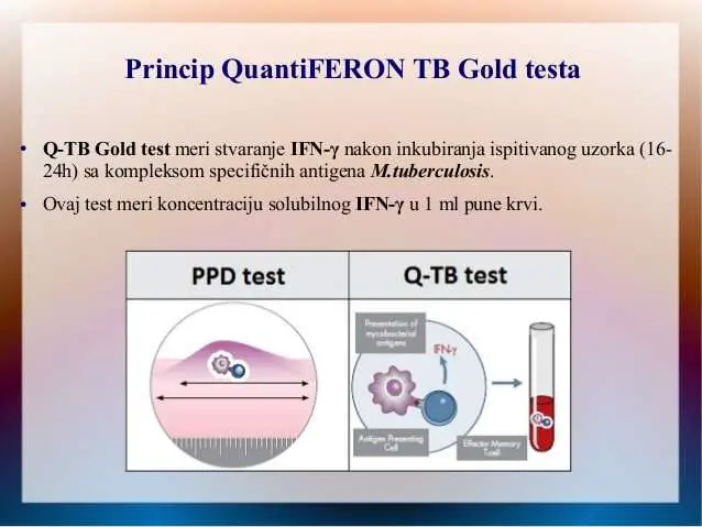 QuantiFERON TB Gold u reumatologiji