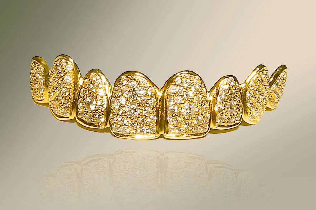 The worlds most expensive smile: Dubai dentist crafts ...