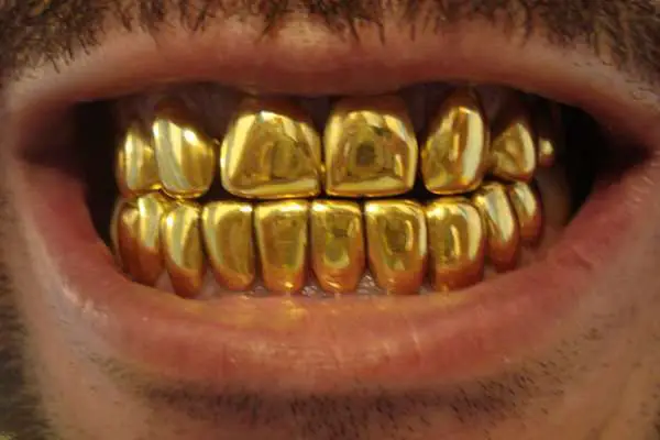 Where Can I Get Permanent Gold Teeth In Florida